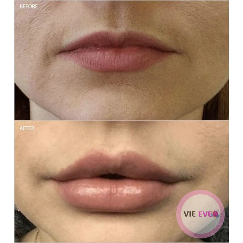 24K Gold Anti-Aging Lip Oil | Huile pour les lèvres anti-âge à l'or 24K - ImbattablePlus