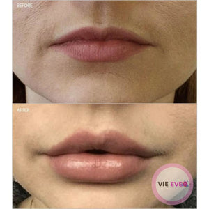 24K Gold Anti-Aging Lip Oil | Huile pour les lèvres anti-âge à l'or 24K - ImbattablePlus
